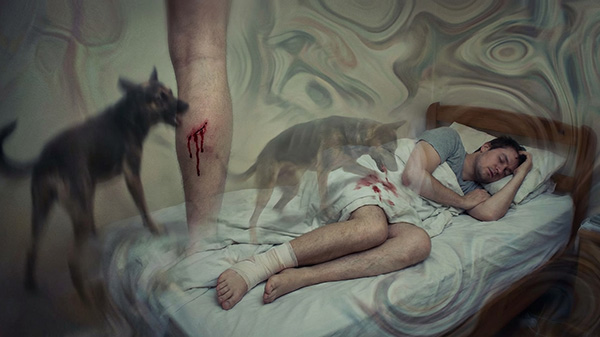 nằm mơ thấy chó cắn vào chân chảy máu